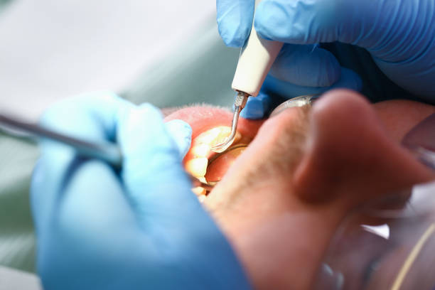Best Urgent Tooth Repair  in Rural Hill, TN