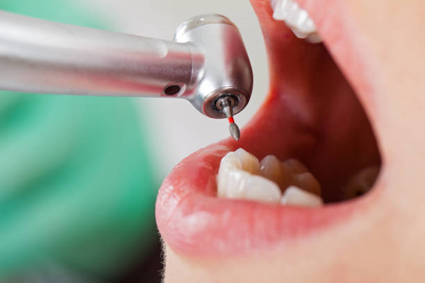 Best Broken Tooth Emergency  in Rural Hill, TN